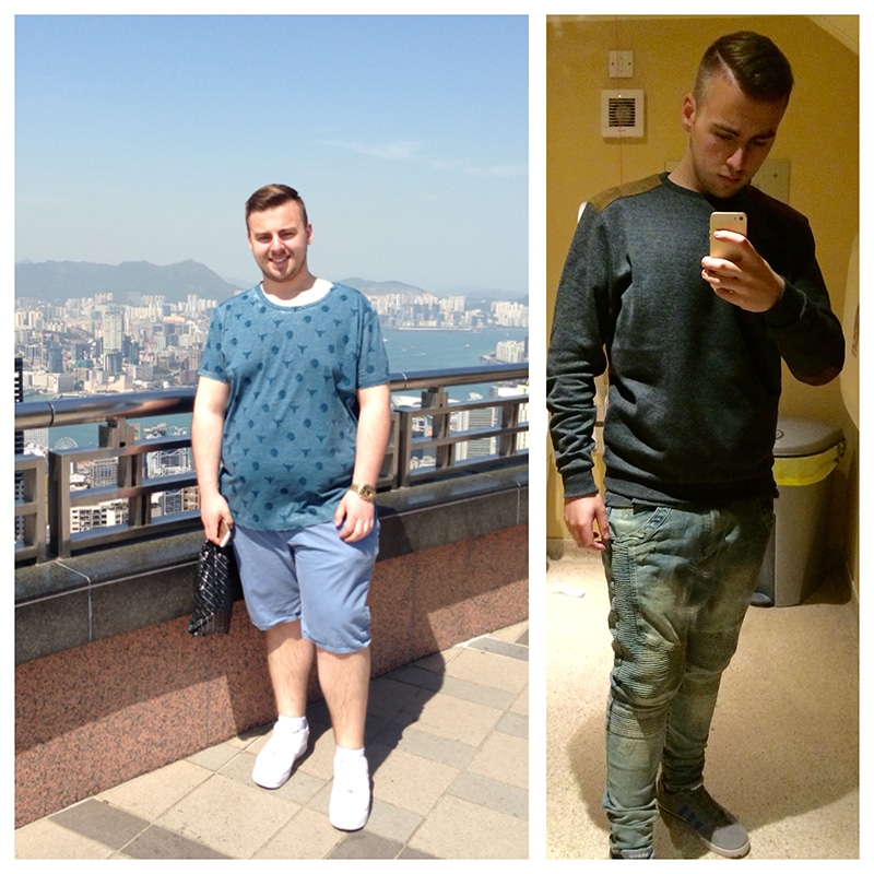 Patient Story: Kieran’s Story