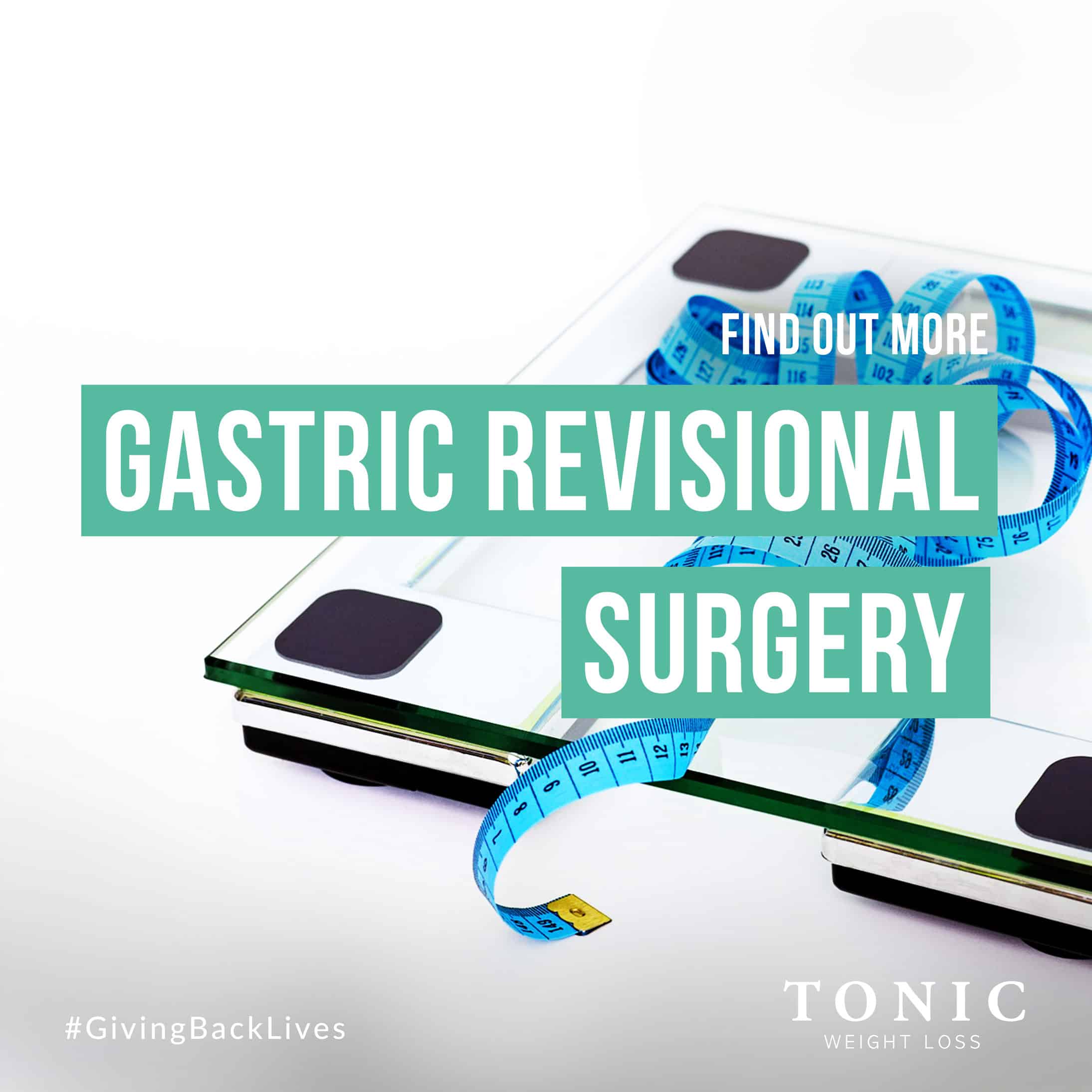 Gastric Revisional Surgery – Find Out More