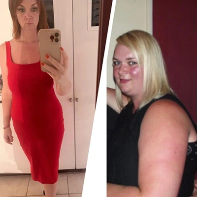 Photo of Tonic Weight Loss Patient Before and After