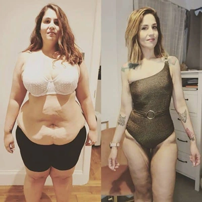 Photo of Tonic Weight Loss Patient Before and After