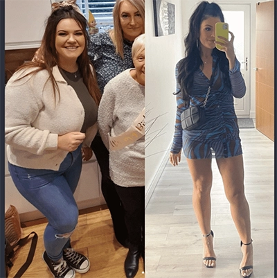 Photo of Tonic Weight Loss Patient Before and After