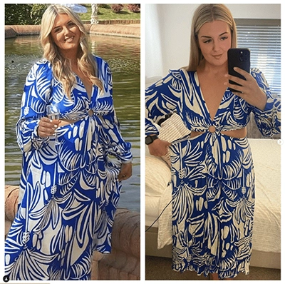 Photo of Tonic Weight Loss Patient Before and After