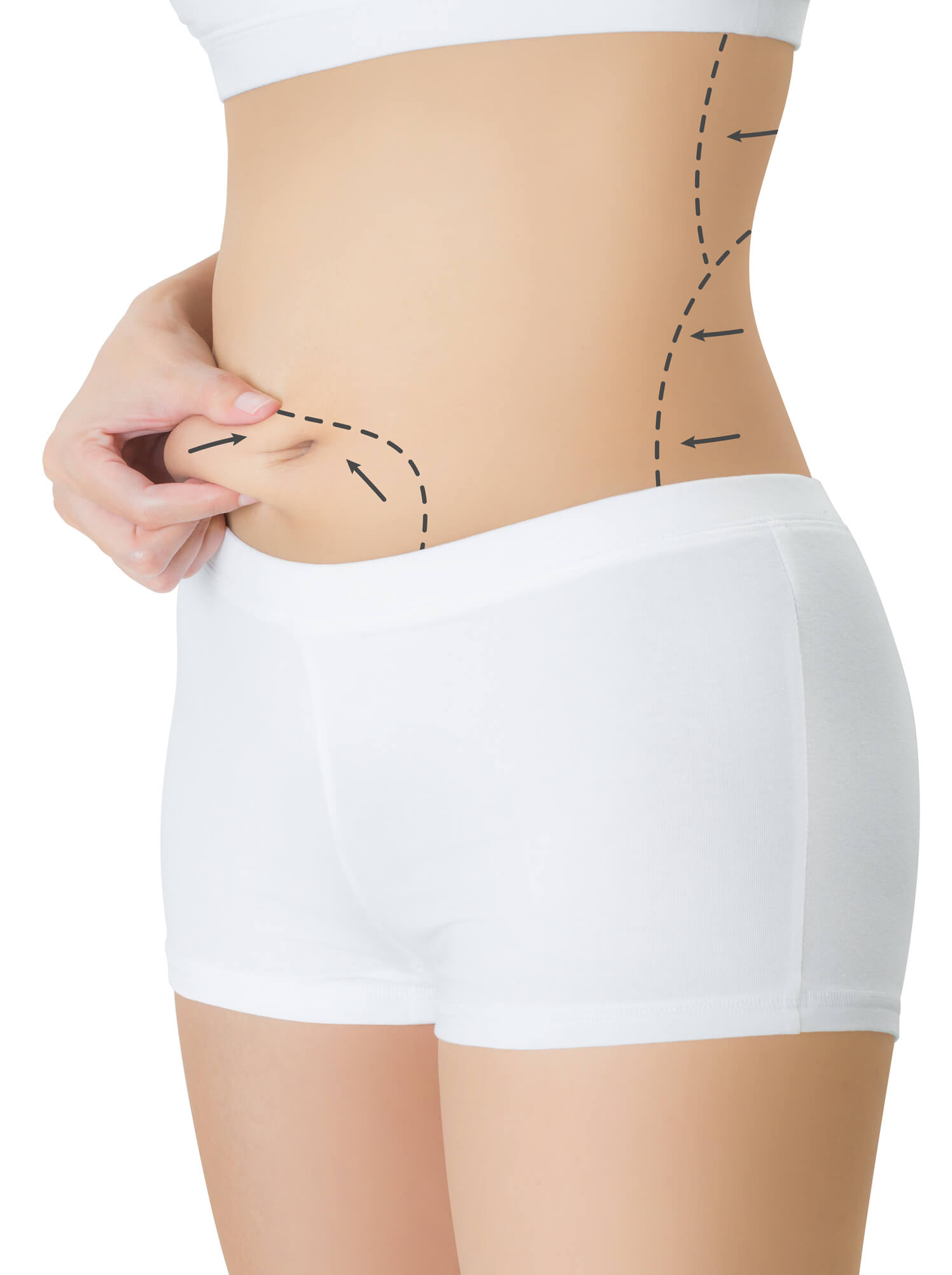 How Much Does Weight Loss Surgery Cost in the UK?