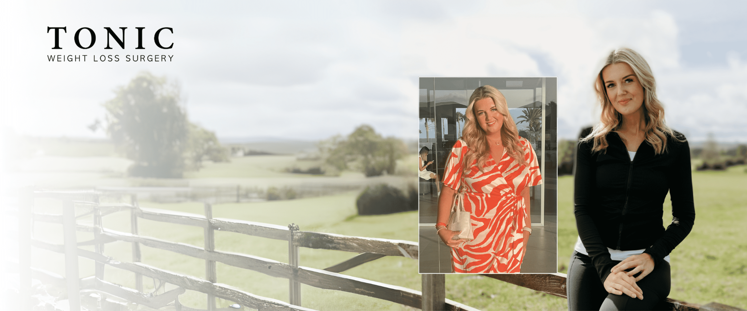essie’s weight loss transformation — before and after photos showing a 7 stone weight loss with Tonic Weight Loss Surgery.