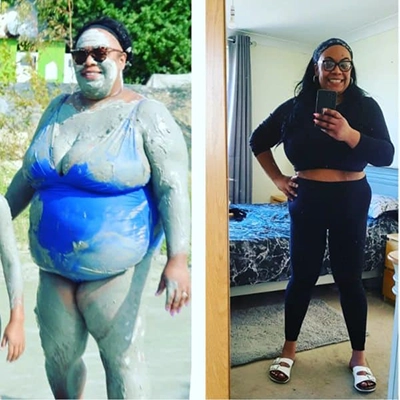 Photo of Tonic Weight Loss Patient Before and After