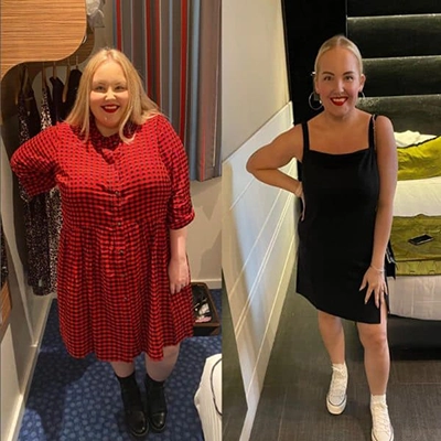 Photo of Tonic Weight Loss Patient Before and After