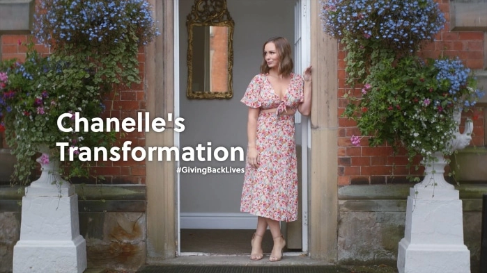 Chanelle Hayes Gastric Sleeve Surgery Transformation