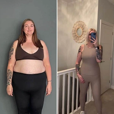 Photo of Tonic Weight Loss Patient Before and After