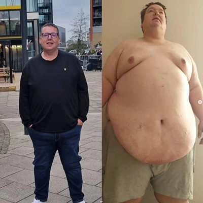 Photo of Tonic Weight Loss Patient Before and After