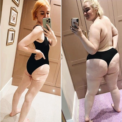 Photo of Tonic Weight Loss Patient Before and After