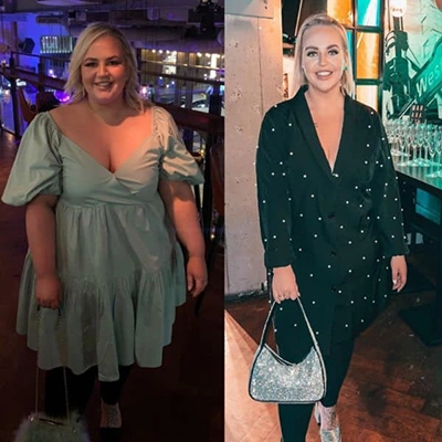 Photo of Tonic Weight Loss Patient Before and After