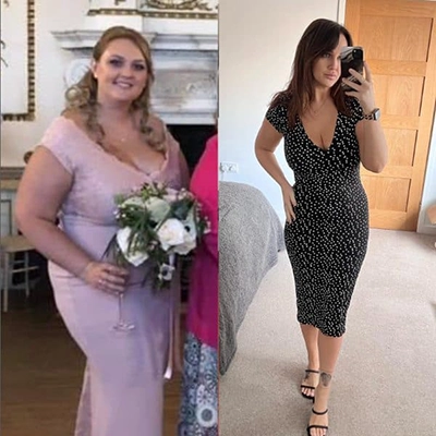 Photo of Tonic Weight Loss Patient Before and After