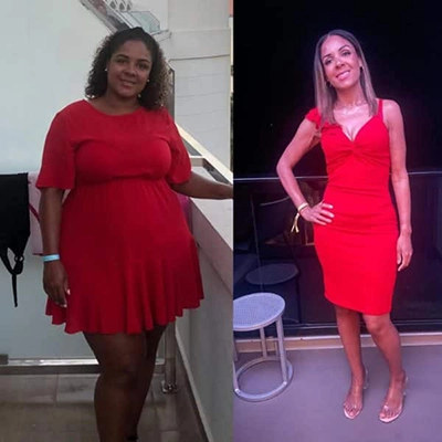 Photo of Tonic Weight Loss Patient Before and After