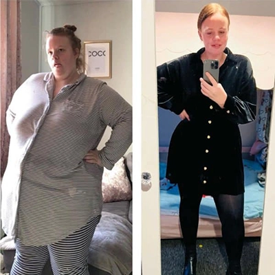 Photo of Tonic Weight Loss Patient Before and After