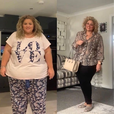 Photo of Tonic Weight Loss Patient Before and After