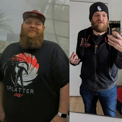Photo of Tonic Weight Loss Patient Before and After