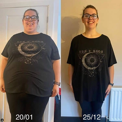 Photo of Tonic Weight Loss Patient Before and After