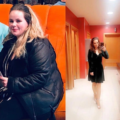 Photo of Tonic Weight Loss Patient Before and After