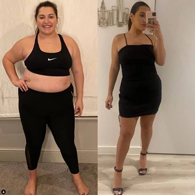 Photo of Tonic Weight Loss Patient Before and After