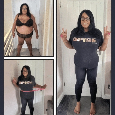 Photo of Tonic Weight Loss Patient Before and After