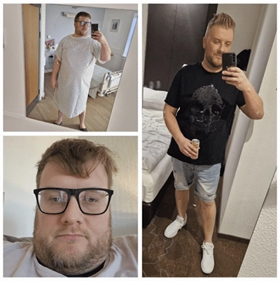 Photo of Tonic Weight Loss Patient Before and After