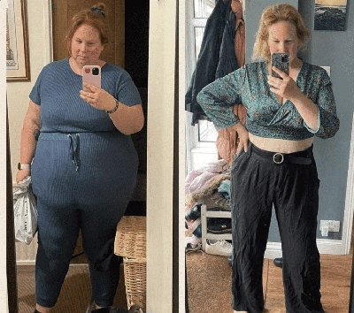 Photo of Tonic Weight Loss Patient Before and After