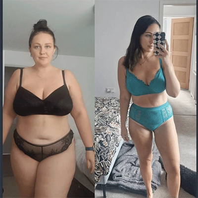 Photo of Tonic Weight Loss Patient Before and After