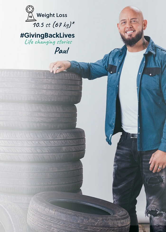 Photo of Weight Loss Patient Next to Tyres